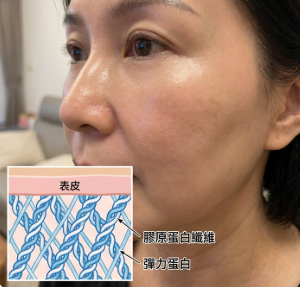 回復彈性
